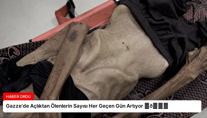 Gazze’de Açlıktan Ölenlerin Sayısı Her Geçen Gün Artıyor ⏬👇